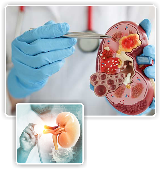 best Nephrologist in thane